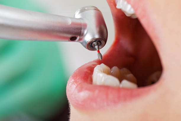 Best Emergency Dental Services for Seniors in Orchards, WA